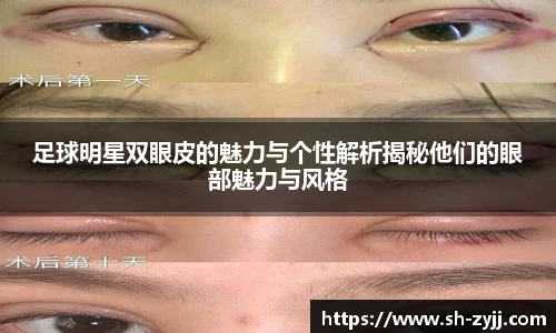 足球明星双眼皮的魅力与个性解析揭秘他们的眼部魅力与风格